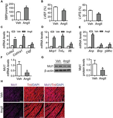 The Anti-apoptotic Role of 3′-Untranslational Region in Response to Angiotensin II via Mcl1 Expression